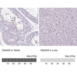 CBE1 Antibody, Novus Biologicals 0.1mL; Unlabeled:Antibodies, Polyclonal